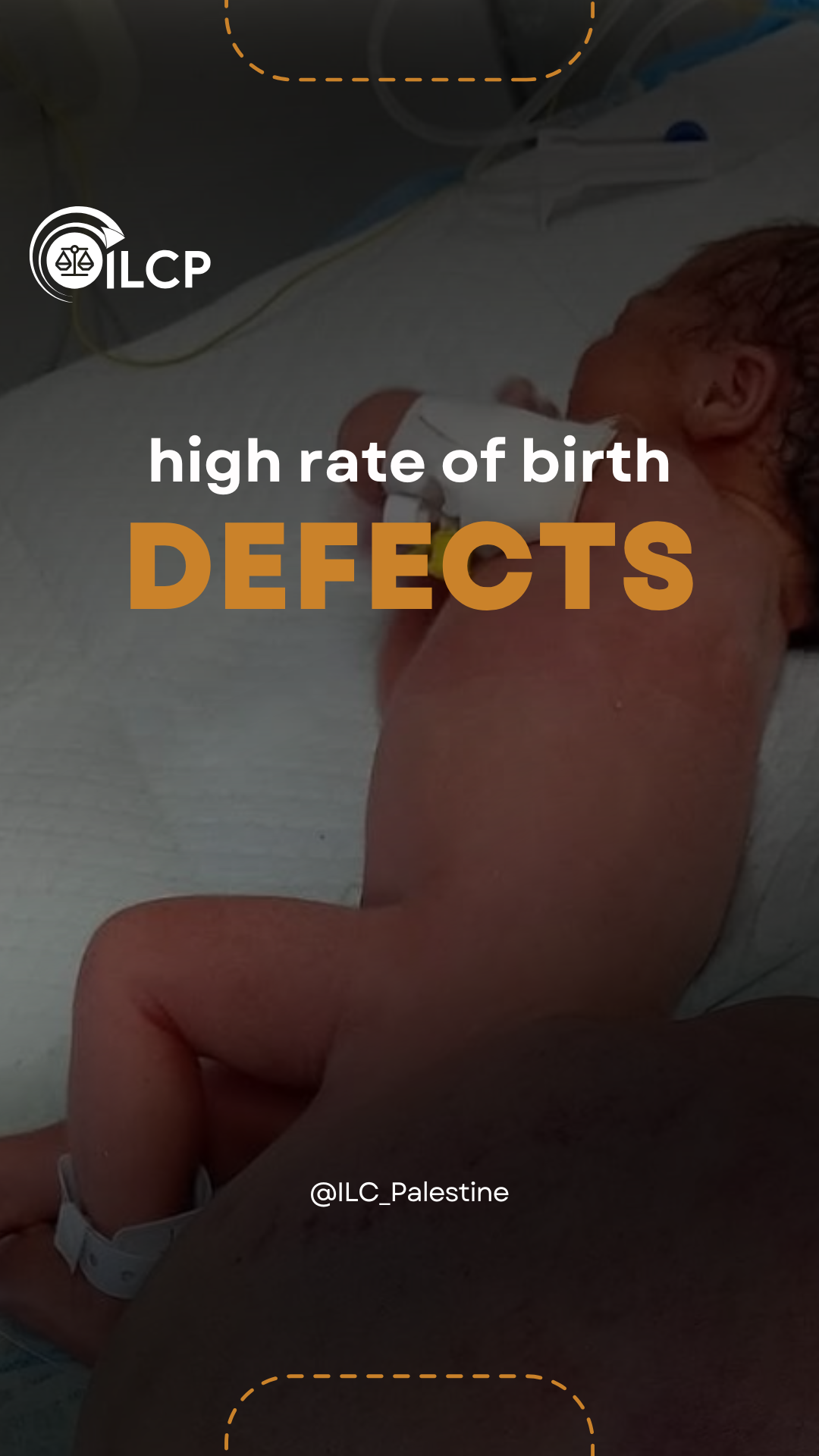 استهداف الأجنة